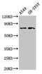 Mannan Binding Lectin Serine Peptidase 2 antibody, CSB-PA013510LA01HU, Cusabio, Western Blot image 