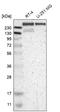 p53BP1 antibody, HPA008788, Atlas Antibodies, Western Blot image 