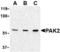 P21 (RAC1) Activated Kinase 2 antibody, TA306346, Origene, Western Blot image 