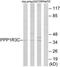 Protein Phosphatase 1 Regulatory Subunit 3C antibody, TA314373, Origene, Western Blot image 