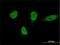 E3 ubiquitin-protein ligase RNF220 antibody, H00055182-M01, Novus Biologicals, Immunocytochemistry image 