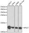 Ribosomal Protein S27 antibody, GTX32727, GeneTex, Western Blot image 