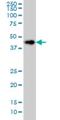 LAG1 longevity assurance homolog 6 antibody, H00253782-M01, Novus Biologicals, Western Blot image 