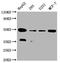 Ubiquinol-Cytochrome C Reductase Core Protein 2 antibody, CSB-RA229127A0HU, Cusabio, Western Blot image 