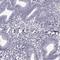 Leucine Rich Repeat Containing 27 antibody, HPA067395, Atlas Antibodies, Immunohistochemistry paraffin image 
