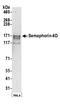 Semaphorin-6D antibody, A304-477A, Bethyl Labs, Western Blot image 
