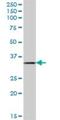 Dehydrogenase/Reductase X-Linked antibody, H00207063-B01P, Novus Biologicals, Western Blot image 