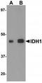 Isocitrate Dehydrogenase (NADP(+)) 1, Cytosolic antibody, TA319663, Origene, Western Blot image 