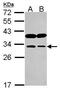 Inositol Monophosphatase 1 antibody, GTX115007, GeneTex, Western Blot image 