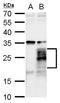 Fibroblast growth factor 18 antibody, GTX128496, GeneTex, Western Blot image 