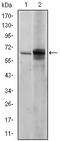 FYN Proto-Oncogene, Src Family Tyrosine Kinase antibody, AM06642SU-N, Origene, Western Blot image 