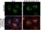 Microtubule Associated Protein 1 Light Chain 3 Beta 2 antibody, PA5-32254, Invitrogen Antibodies, Immunofluorescence image 