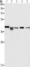 Isocitrate Dehydrogenase (NAD(+)) 3 Beta antibody, TA349541, Origene, Western Blot image 