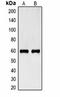 His tag antibody, orb323078, Biorbyt, Western Blot image 