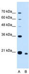 Cell Division Cycle Associated 4 antibody, TA339729, Origene, Western Blot image 