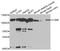 Cartilage Oligomeric Matrix Protein antibody, TA332931, Origene, Western Blot image 