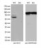 SS18 Subunit Of BAF Chromatin Remodeling Complex antibody, M03947, Boster Biological Technology, Western Blot image 
