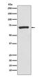 5 -NT antibody, M02120-1, Boster Biological Technology, Western Blot image 