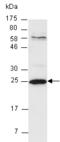 Neurofibromin 1 antibody, orb67141, Biorbyt, Western Blot image 
