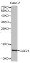 C-C motif chemokine 21 antibody, abx001555, Abbexa, Western Blot image 