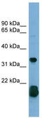 Ras Homolog Family Member F, Filopodia Associated antibody, TA344827, Origene, Western Blot image 