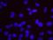 Replication Timing Regulatory Factor 1 antibody, NB100-1585, Novus Biologicals, Proximity Ligation Assay image 