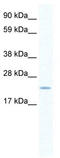 SERTA domain-containing protein 1 antibody, TA335638, Origene, Western Blot image 