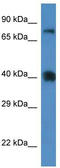 Cationic amino acid transporter 3 antibody, TA333604, Origene, Western Blot image 