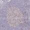 Derlin 2 antibody, NBP2-49231, Novus Biologicals, Immunohistochemistry frozen image 