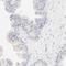 Spectrin Beta, Erythrocytic antibody, HPA003394, Atlas Antibodies, Immunohistochemistry paraffin image 