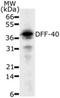 DNA Fragmentation Factor Subunit Beta antibody, NB120-13592, Novus Biologicals, Western Blot image 