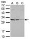 BCL10 Immune Signaling Adaptor antibody, GTX113048, GeneTex, Western Blot image 
