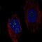 Chromosome 6 Open Reading Frame 223 antibody, NBP2-76532, Novus Biologicals, Immunocytochemistry image 