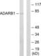 Double-stranded RNA-specific editase 1 antibody, LS-C118968, Lifespan Biosciences, Western Blot image 