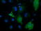 Peroxisomal trans-2-enoyl-CoA reductase antibody, TA501809, Origene, Immunofluorescence image 