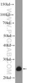 Zinc Finger Matrin-Type 2 antibody, 25819-1-AP, Proteintech Group, Western Blot image 