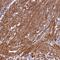 Coiled-Coil Domain Containing 102B antibody, HPA040623, Atlas Antibodies, Immunohistochemistry paraffin image 