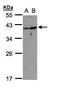 ADP Ribosylation Factor Like GTPase 14 antibody, PA5-21961, Invitrogen Antibodies, Western Blot image 