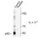 Sequestosome 1 antibody, AHP2270, Bio-Rad (formerly AbD Serotec) , Western Blot image 