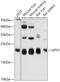 Glutathione Peroxidase 1 antibody, 13-911, ProSci, Western Blot image 