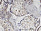 Hematopoietic SH2 domain-containing protein antibody, LS-C134113, Lifespan Biosciences, Immunohistochemistry paraffin image 