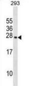 Prolactin antibody, abx029038, Abbexa, Western Blot image 