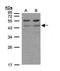 Adrenoceptor Beta 1 antibody, GTX108366, GeneTex, Western Blot image 