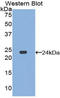 Dishevelled Segment Polarity Protein 1 antibody, LS-C293693, Lifespan Biosciences, Western Blot image 