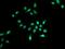 Chloride Voltage-Gated Channel 1 antibody, orb178560, Biorbyt, Immunocytochemistry image 