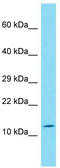 Family With Sequence Similarity 24 Member B antibody, TA335383, Origene, Western Blot image 