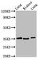 Homeobox D1 antibody, CSB-PA884426LA01HU, Cusabio, Western Blot image 
