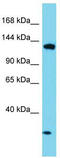 Elongation Factor Like GTPase 1 antibody, TA332232, Origene, Western Blot image 