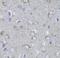 Myosin-10 antibody, FNab05471, FineTest, Immunohistochemistry paraffin image 