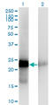 Cbp/P300 Interacting Transactivator With Glu/Asp Rich Carboxy-Terminal Domain 1 antibody, LS-C133330, Lifespan Biosciences, Western Blot image 